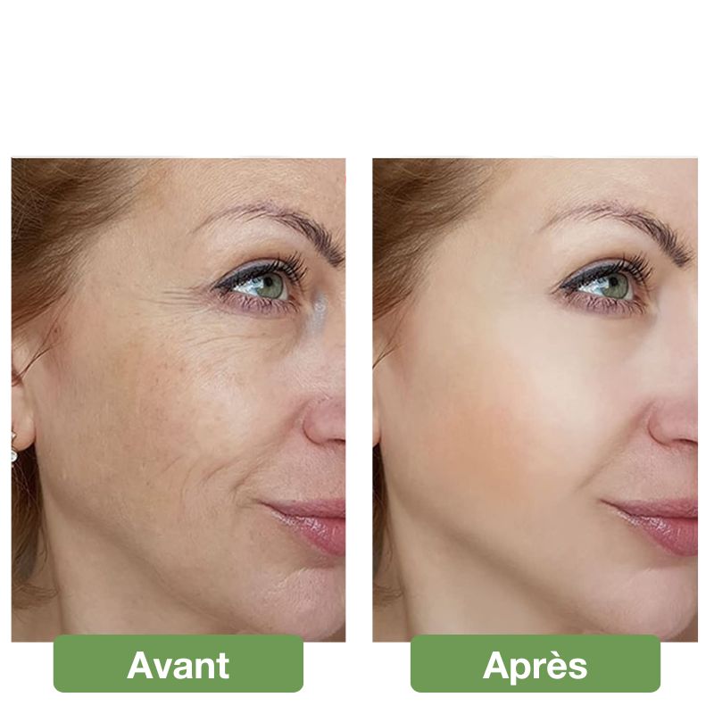Masque facial LED anti-âge