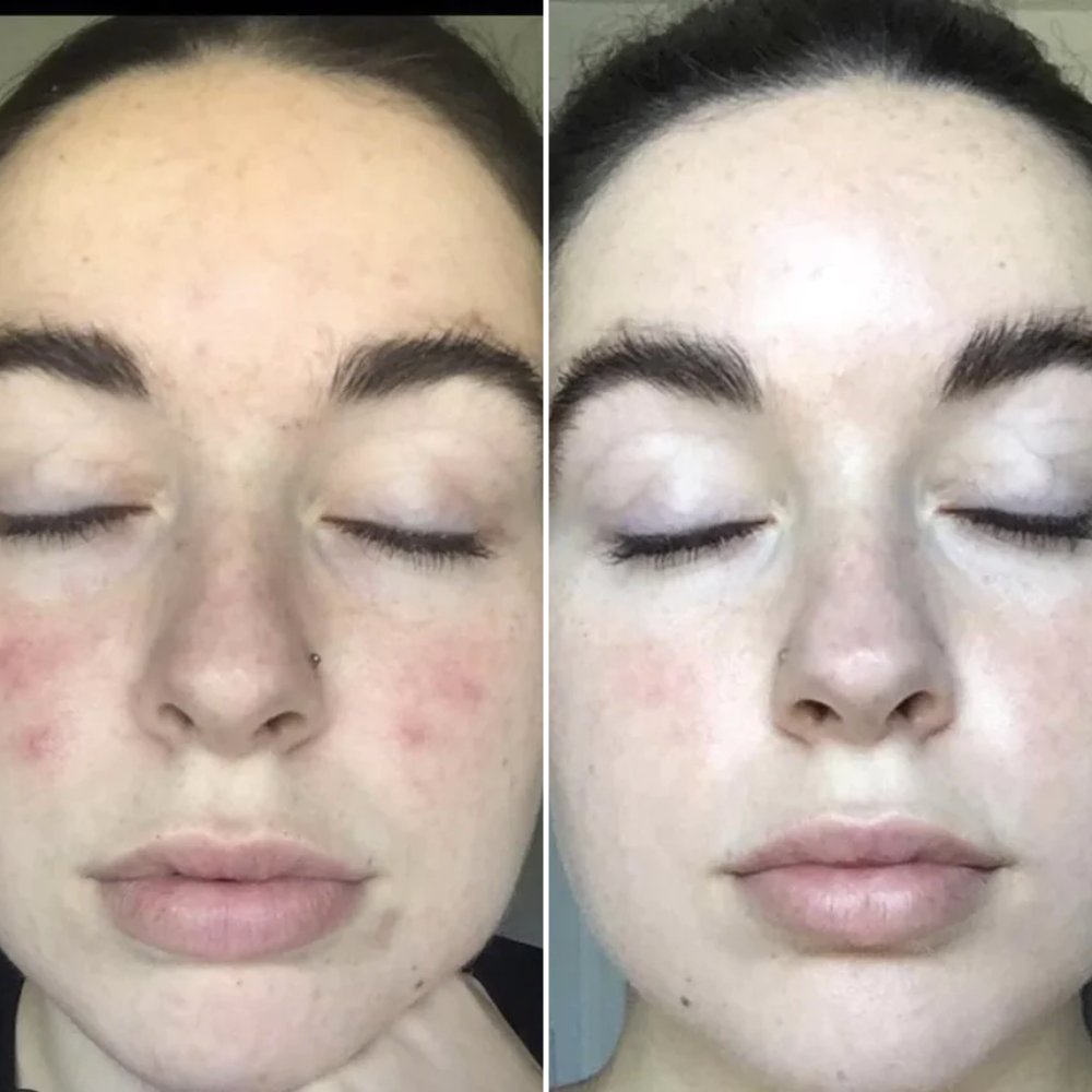 SculptFace Pro