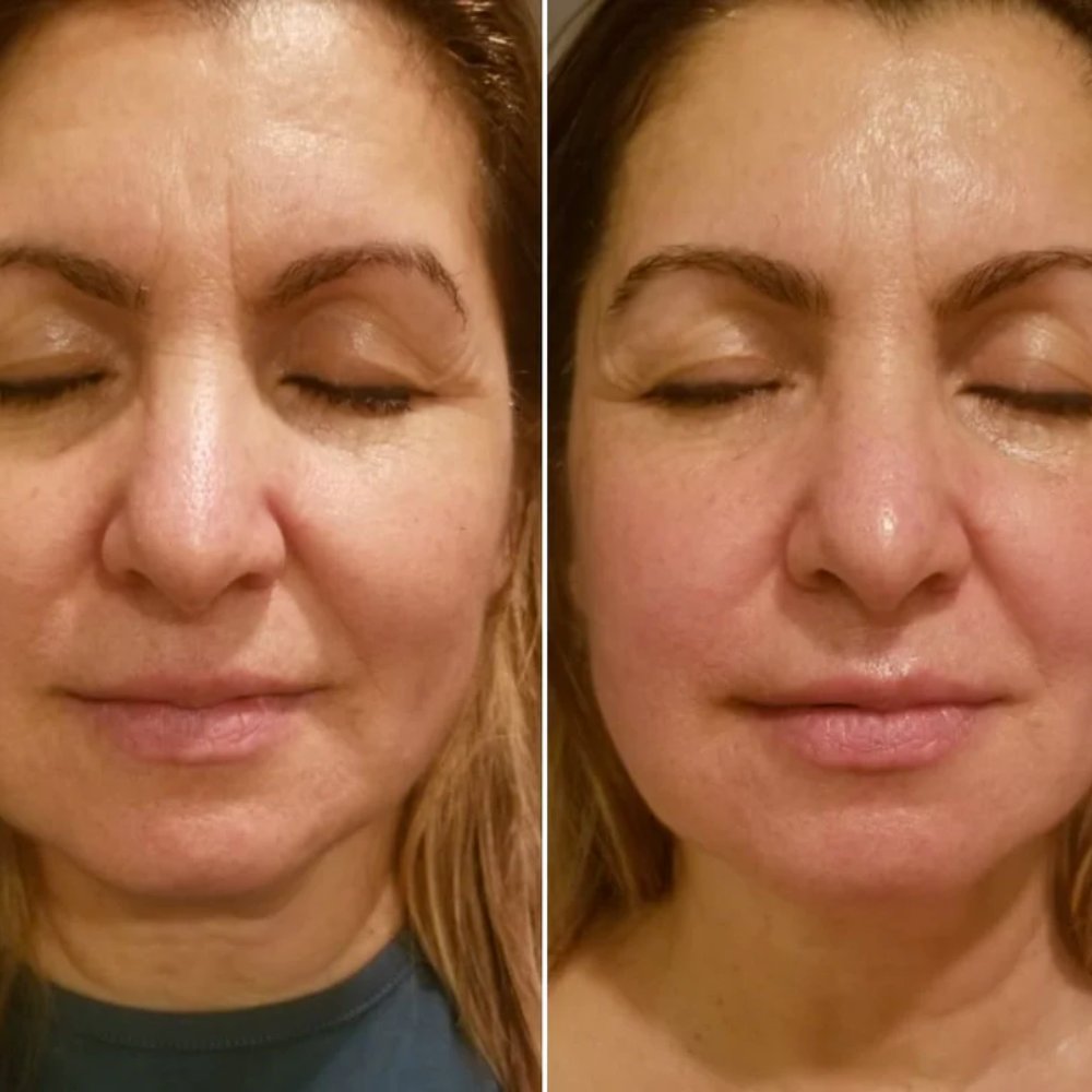 SculptFace Pro