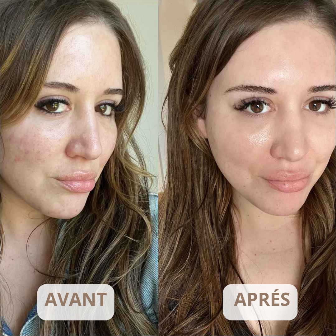 Masque Coréen Bio-Collagène LadiVania™