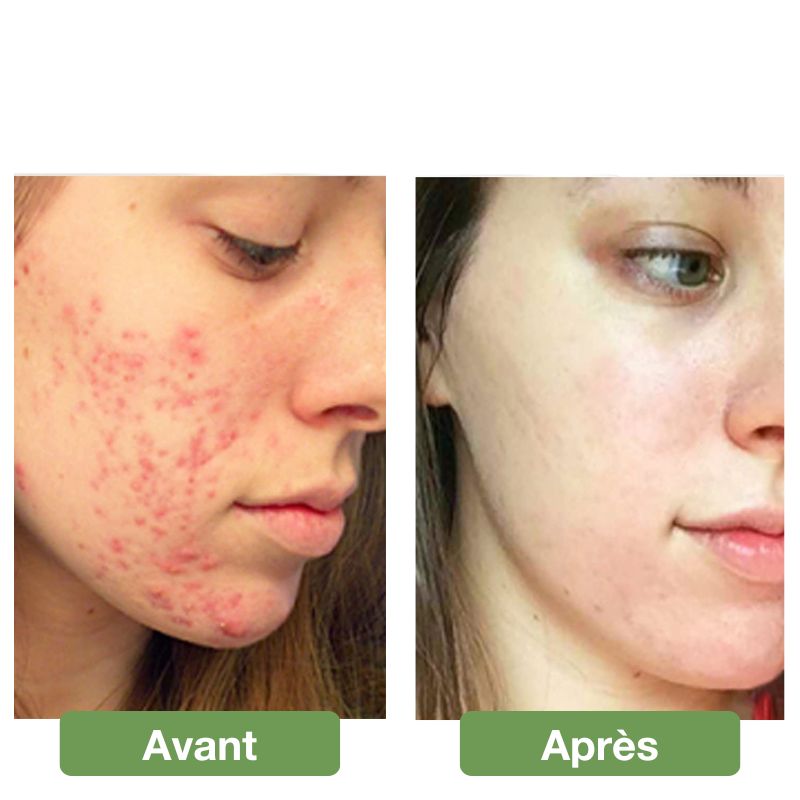 Masque facial LED anti-âge