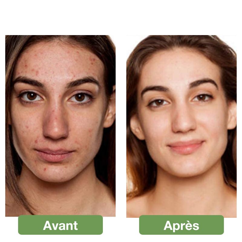 Masque facial LED anti-âge