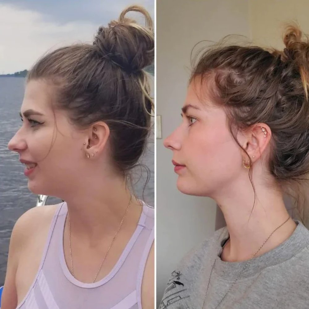 SculptFace Pro